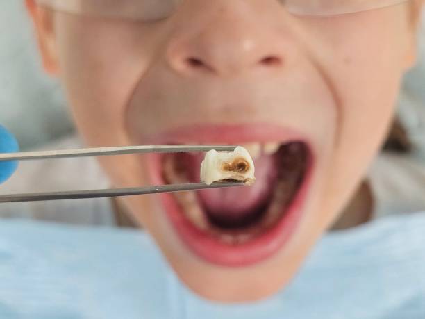 Best Emergency Denture Repair in St Stephen, SC